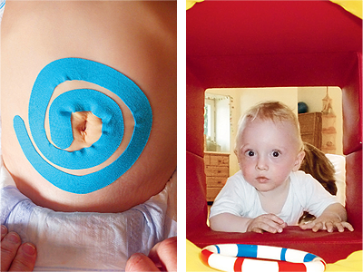 physio ergotherapie kammer und broemme medical taping